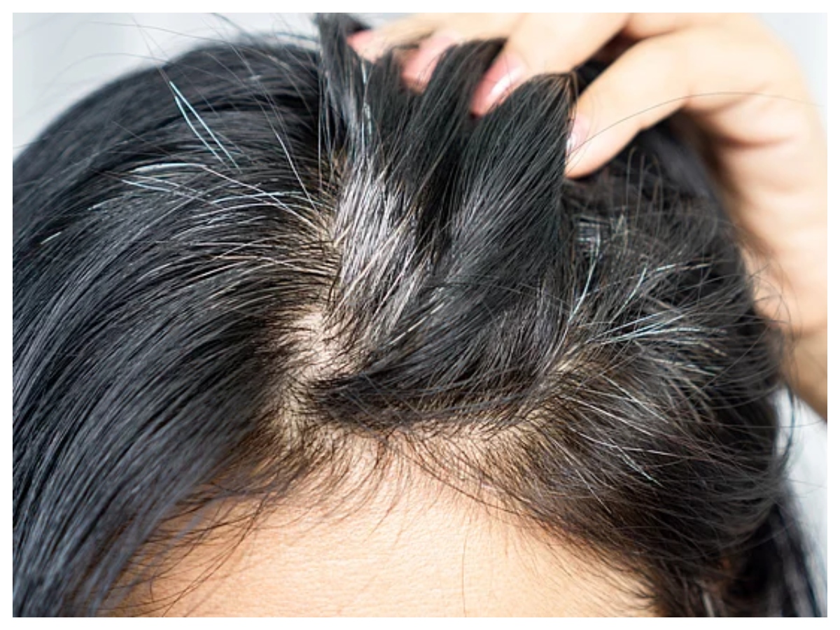 Hair problems: समय से पहले सफेद हो रहे हैं बाल? सही देखभाल से रोकें सफेदी,अपनाएं ये आसान उपाय - Photo Gallery