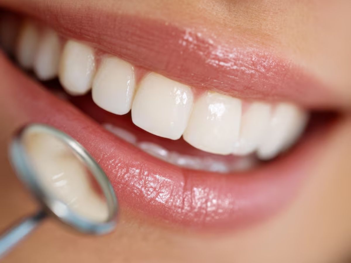 Wisdom Tooth Pain: अक्ल की दाड़ के दर्द से कैसे पाए राहत, जानें तरीका - Photo Gallery